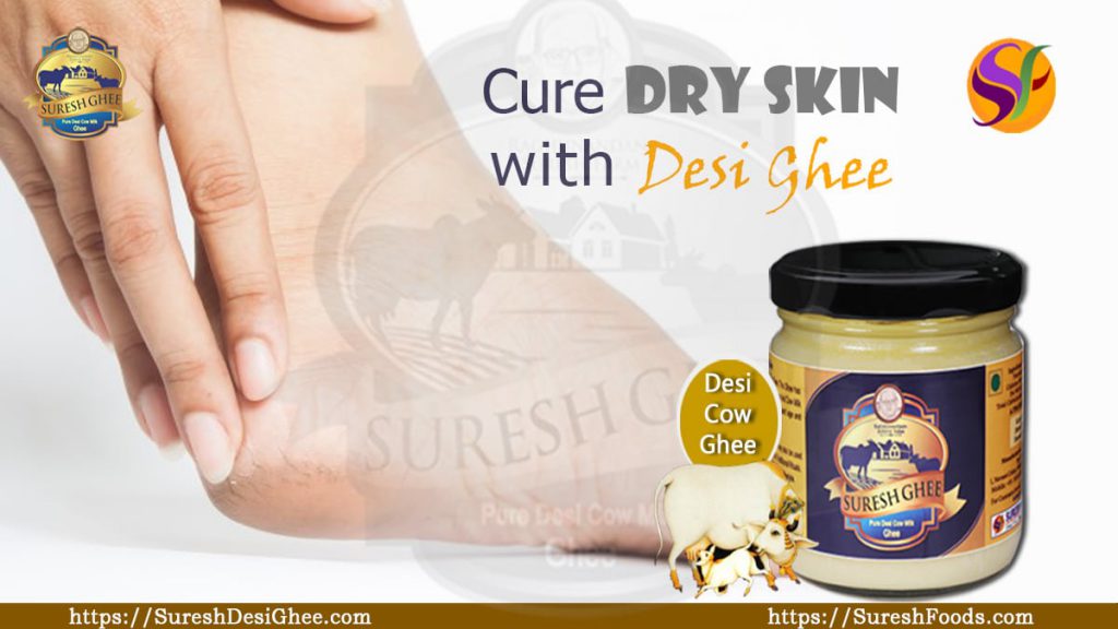 Cure dry skin with desi ghee