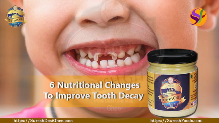 6 Nutritional changes to improve tooth decay : SureshFoods.com